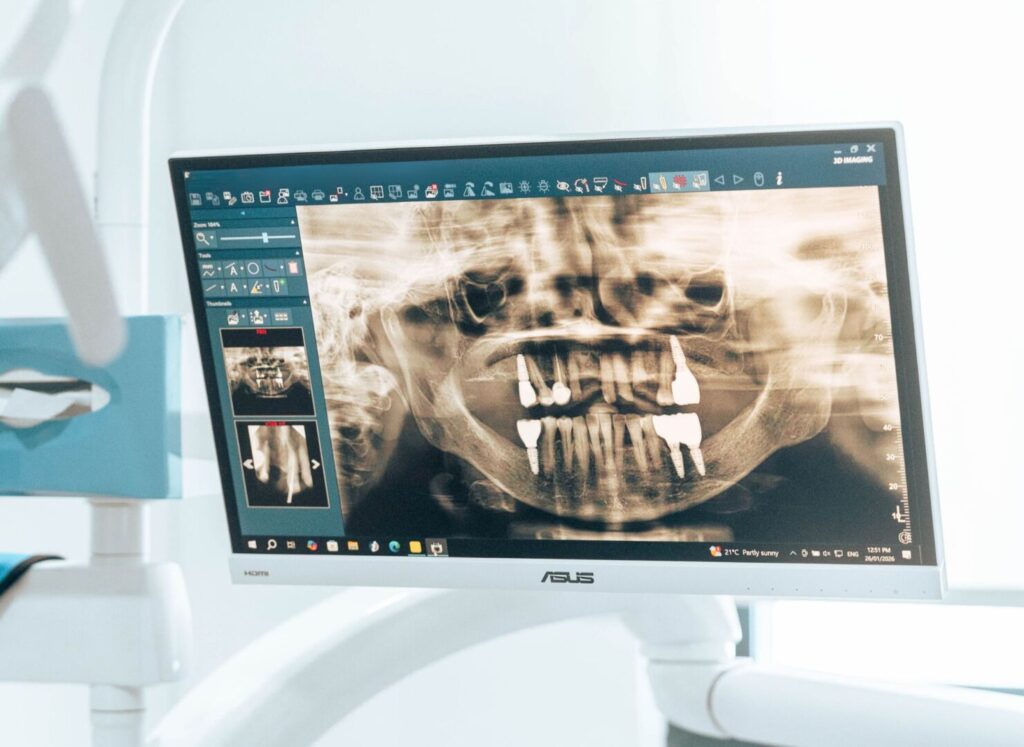 Are Dental Implants Painful