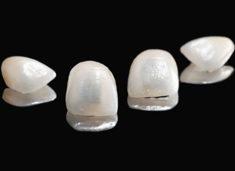 How Long Do Porcelain Veneers Last