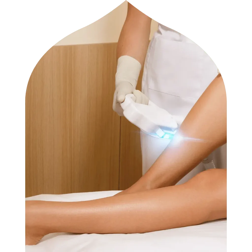 laser hair removal​ in Ras Al Khaimah
