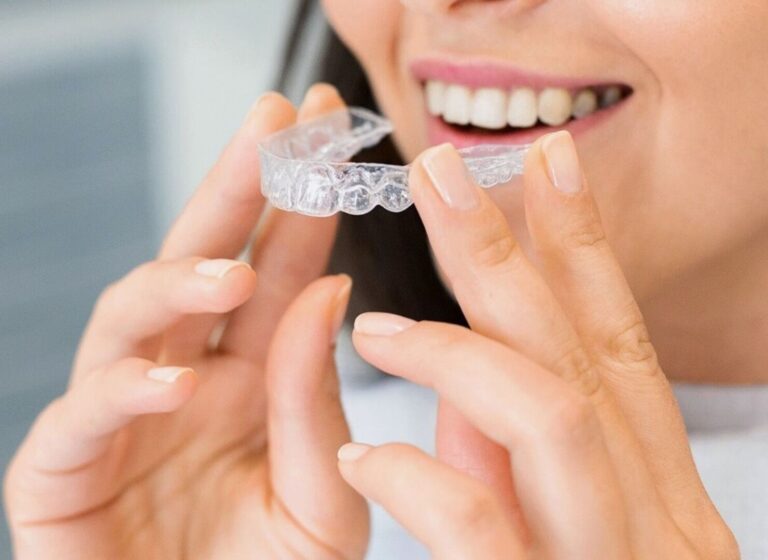Does Invisalign Change Your Face Shape