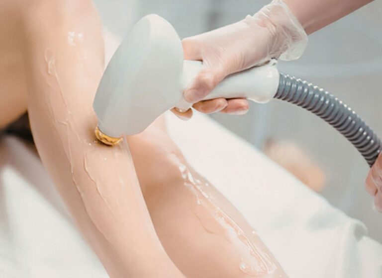can I workout after laser hair removal