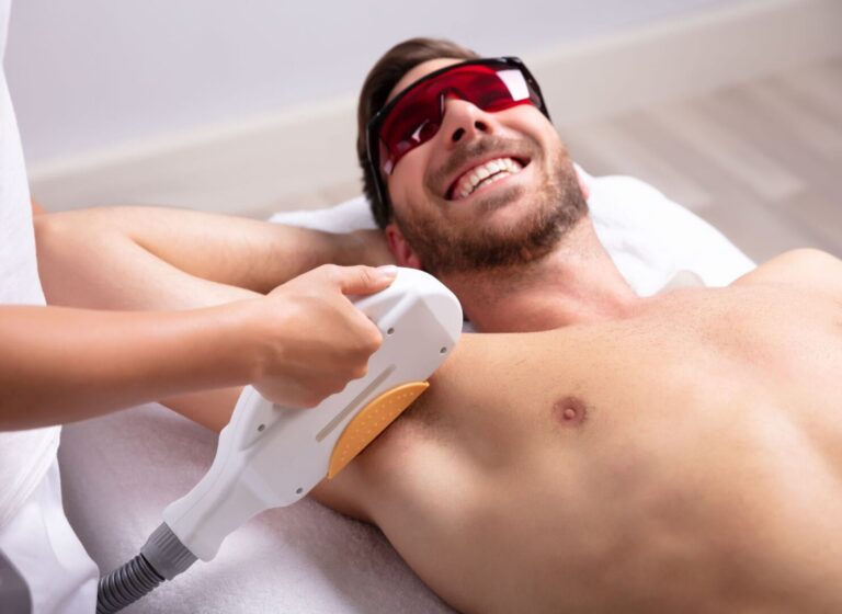 can i put deodorant after laser hair removal