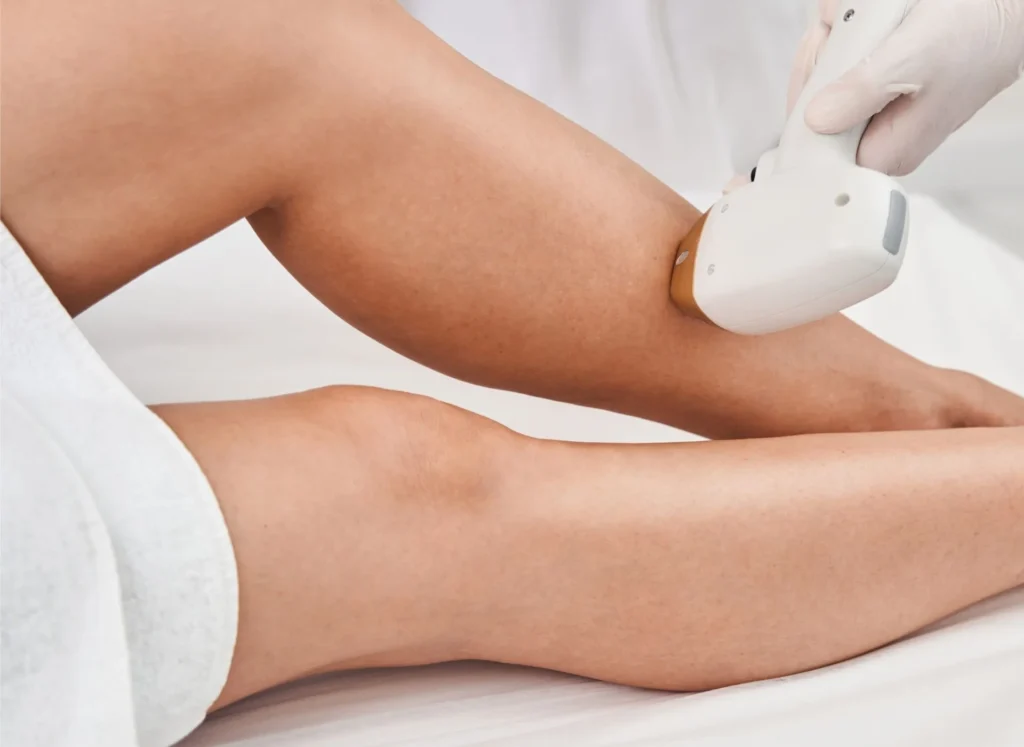 Laser Hair Removal in Dubai
