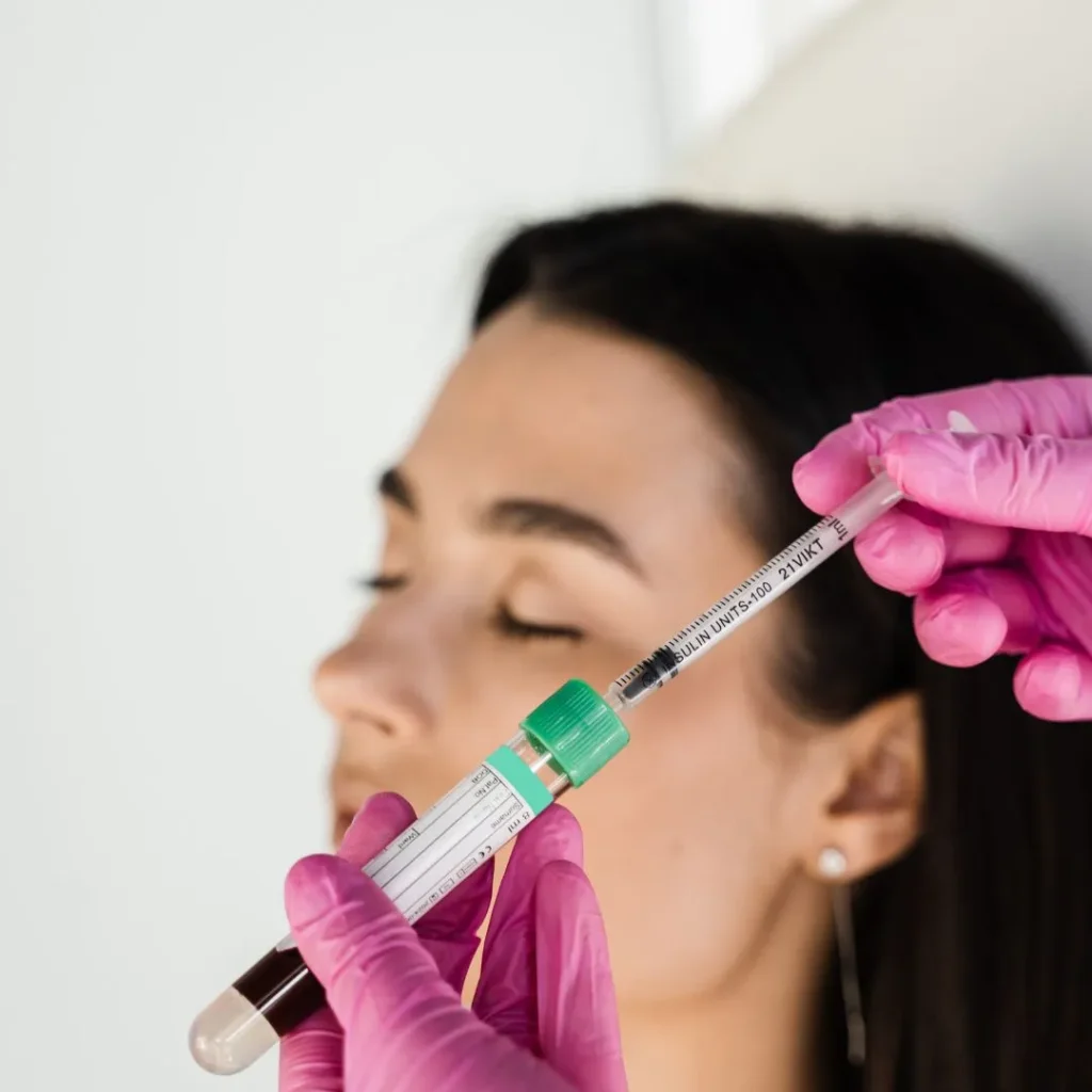 PRP treatment in Ras Al Khaimah