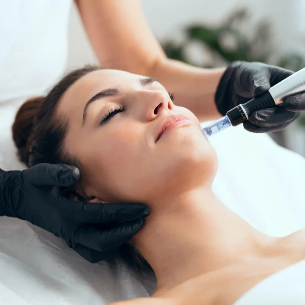 mesotherapy in Ras Al Khaimah